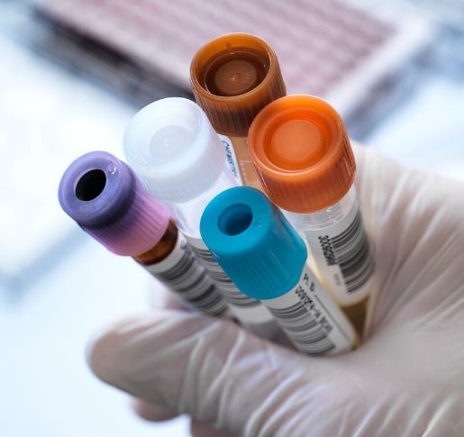 Corona: Was Anleger über Investitionen in die Pharmabranche wissen sollten